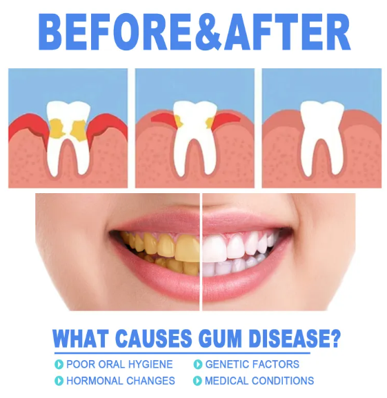 C&M Treasures Teeth Repair Gel tube with applicator for dental repair and oral health treatment.