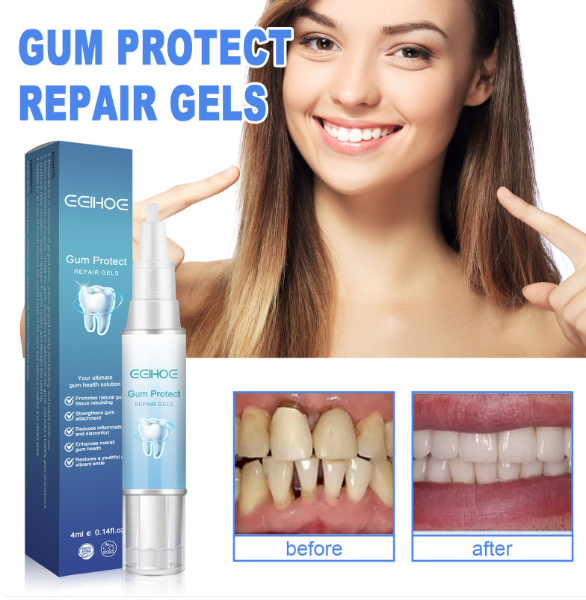 C&M Treasures Teeth Repair Gel tube with applicator, designed to help repair and strengthen damaged teeth.